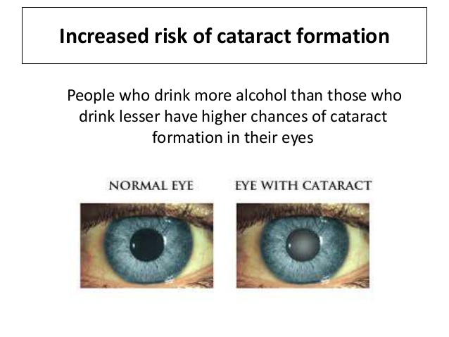 effects-of-alcohol-on-eyes-10-638